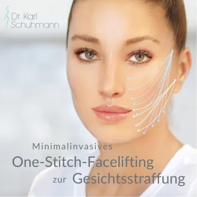 One-Stitch Facelifting - Zukunft der Gesichtsstraffung