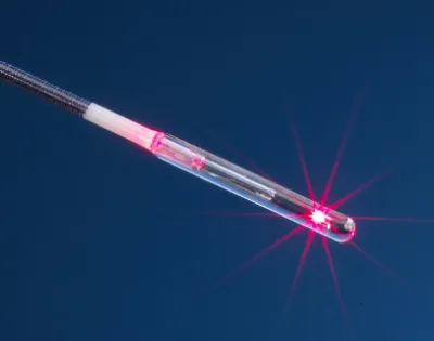 biolitec Lasersystem LEONARDO DUAL zeigt sehr gute Ergebnisse mit radialer FiLaC-Laserfaser bei Akne inversa und Steißbeinfisteln